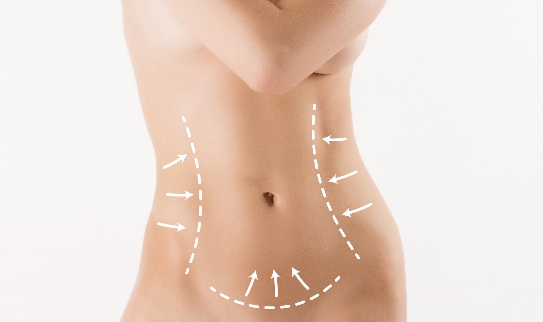 VASER Liposuction vs. Tummy Tuck: Choosing the Best Procedure for You banner