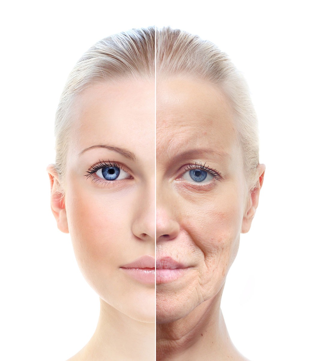 facelift procedure