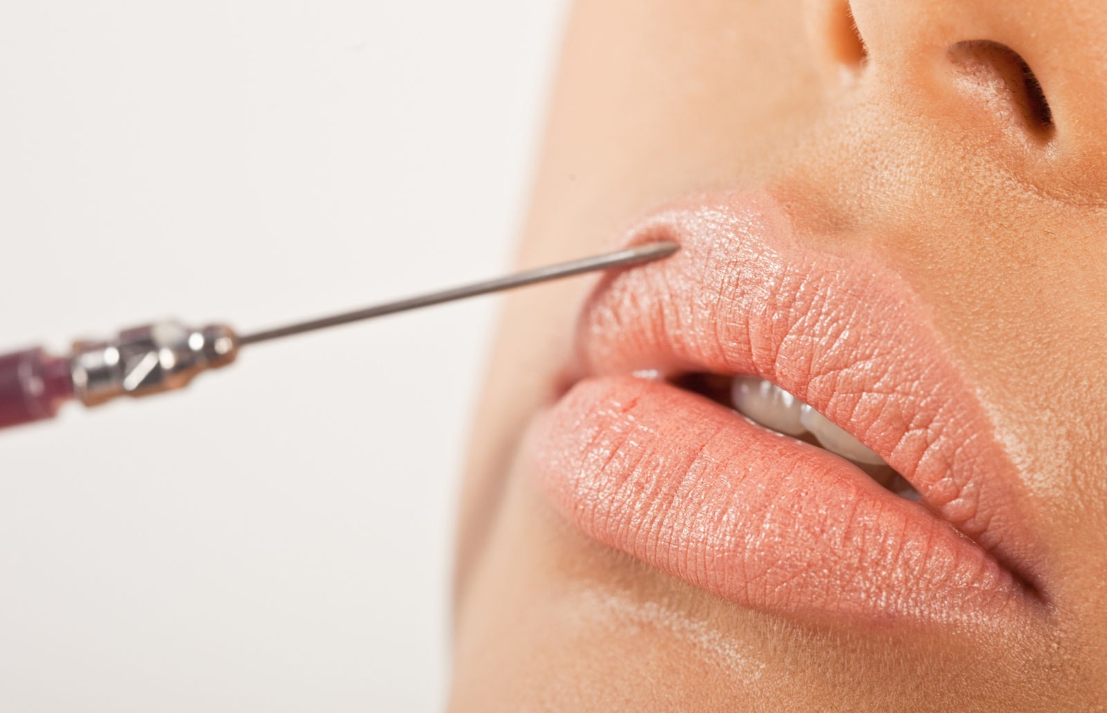 Achieve More Alluring, Plump Lips with Lip Injections banner